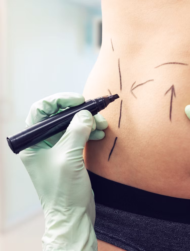Défis de la chirurgie bariatrique